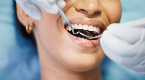 Best Emergency Dentist for Lost Fillings or Crowns in Manchester, TN